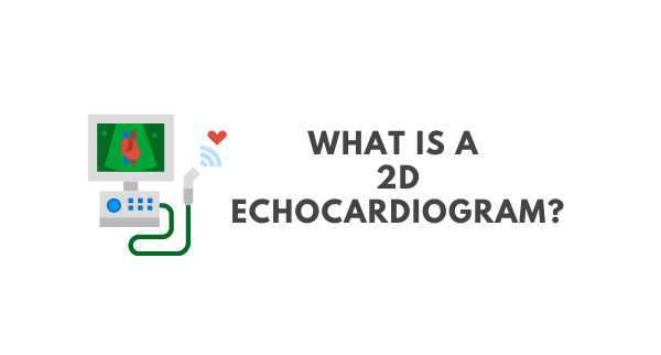 What is a 2D Echocardiogram?