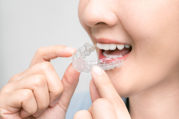 Invisalign